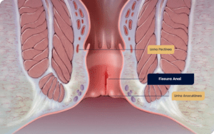 fissura-anal-final