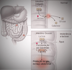 intolerancia-a-lactose-imagem