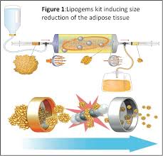 LIPOGENS KIT